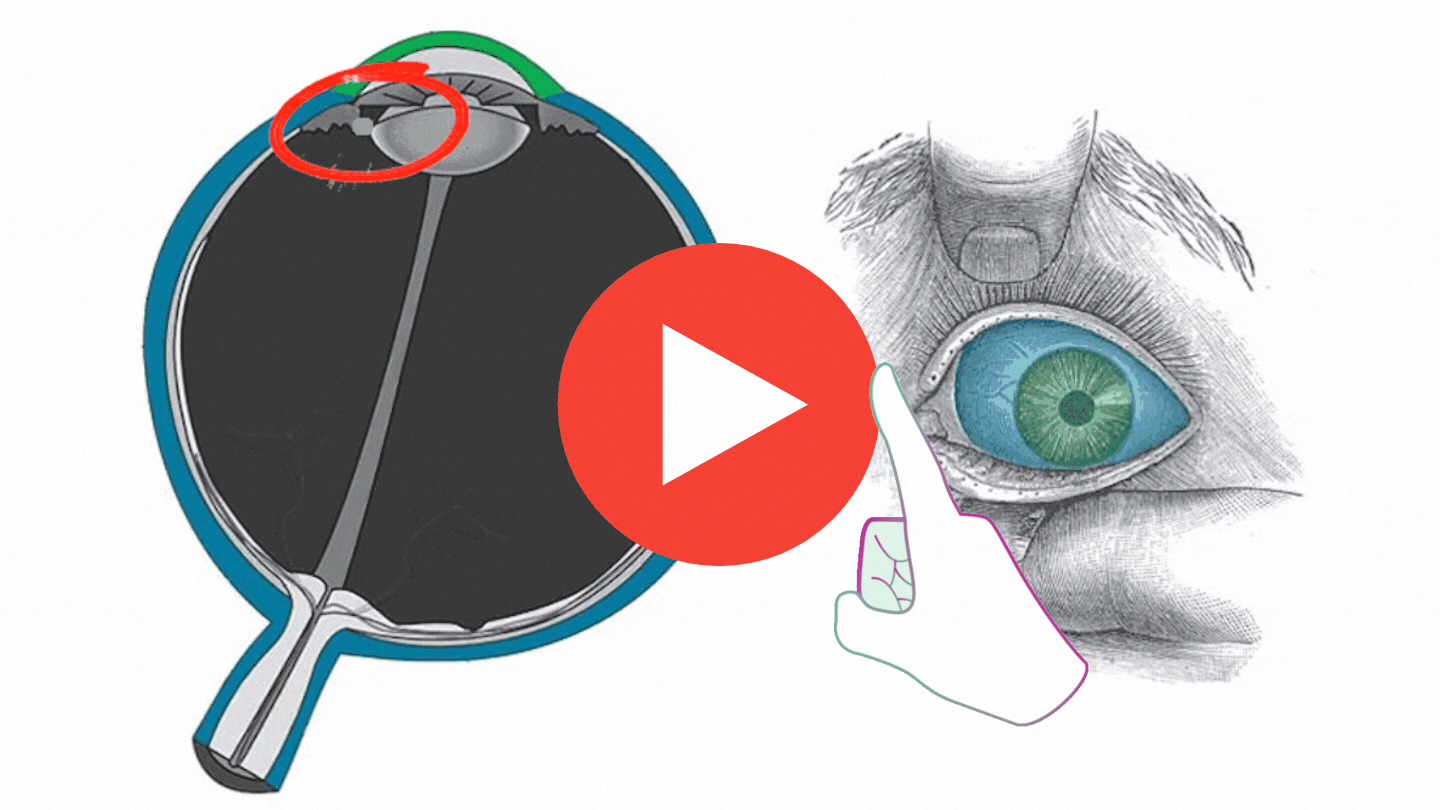 Blind Eye Doctor Reveals the Nobel Prize Winning Breakthrough to